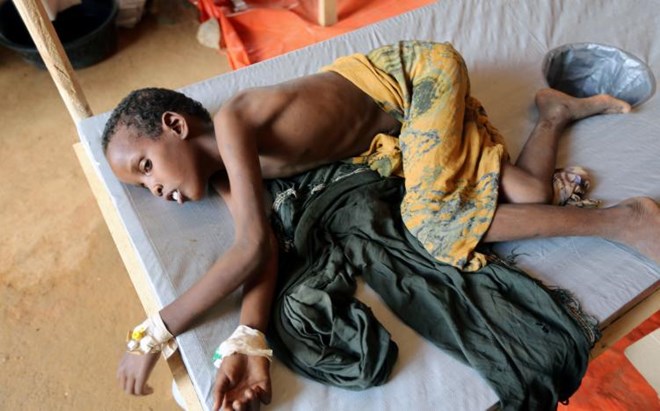 FILE PHOTO: An internally displaced Somali child who fled from drought stricken regions receives treatment inside a hospital ward for diarrhea patients in Baidoa, west of Mogadishu, Somalia March 26, 2017. REUTERS/Feisal Omar /File photo